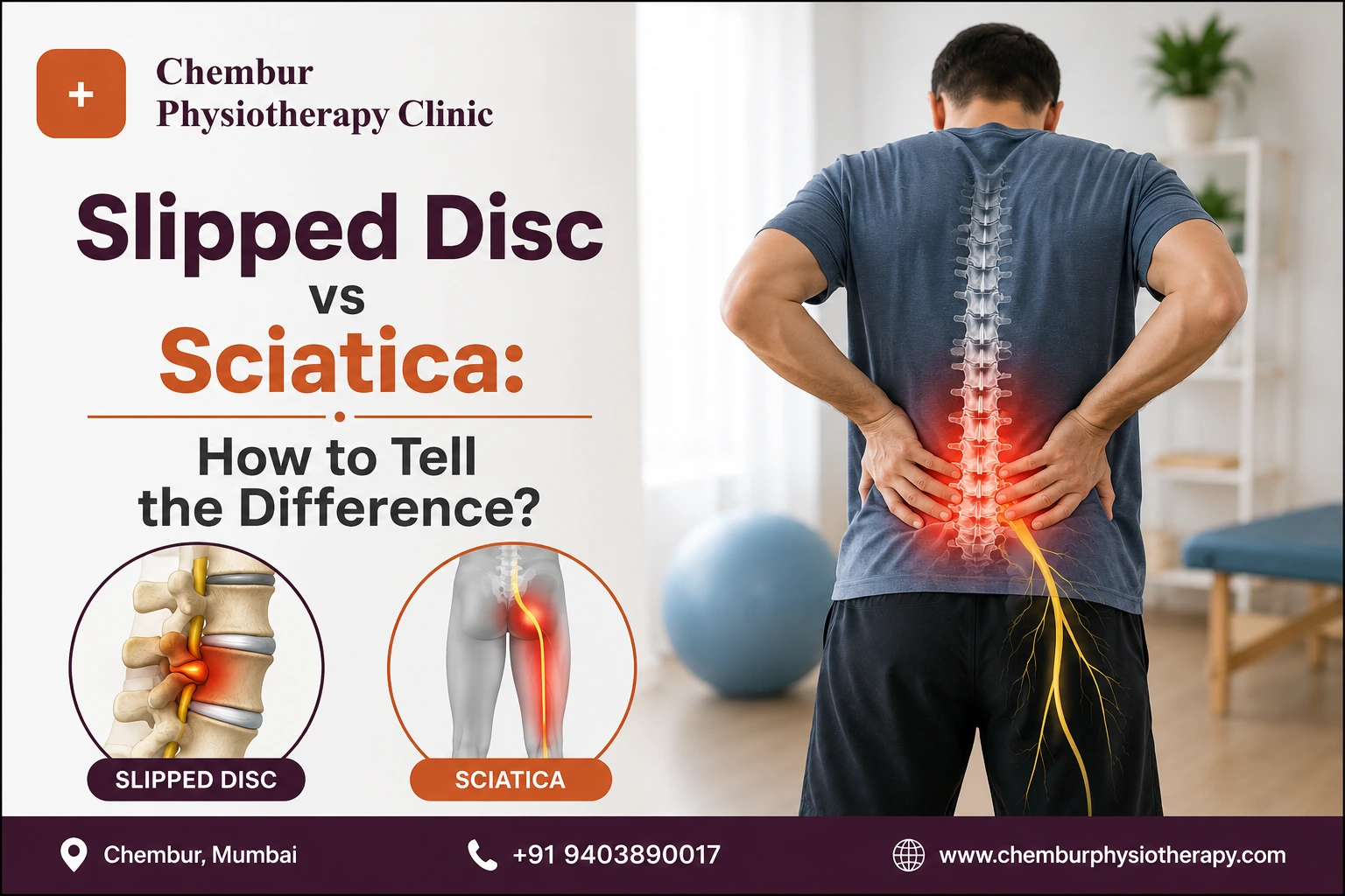 Slipped Disc vs Sciatica Guide